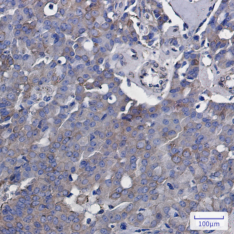 IHC - Rab5 Rabbit mAb AP75987